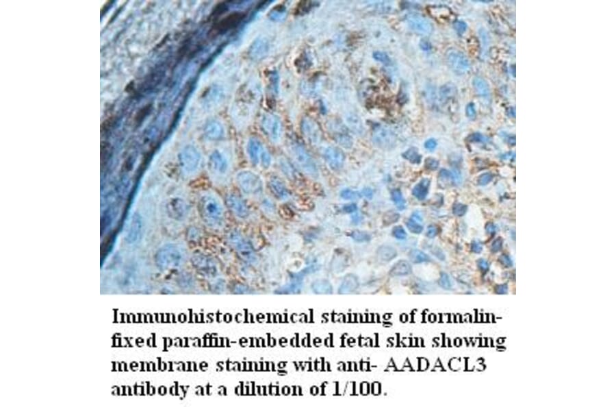 AADACL3 Antibody from Signalway Antibody (39428) - Antibodies.com