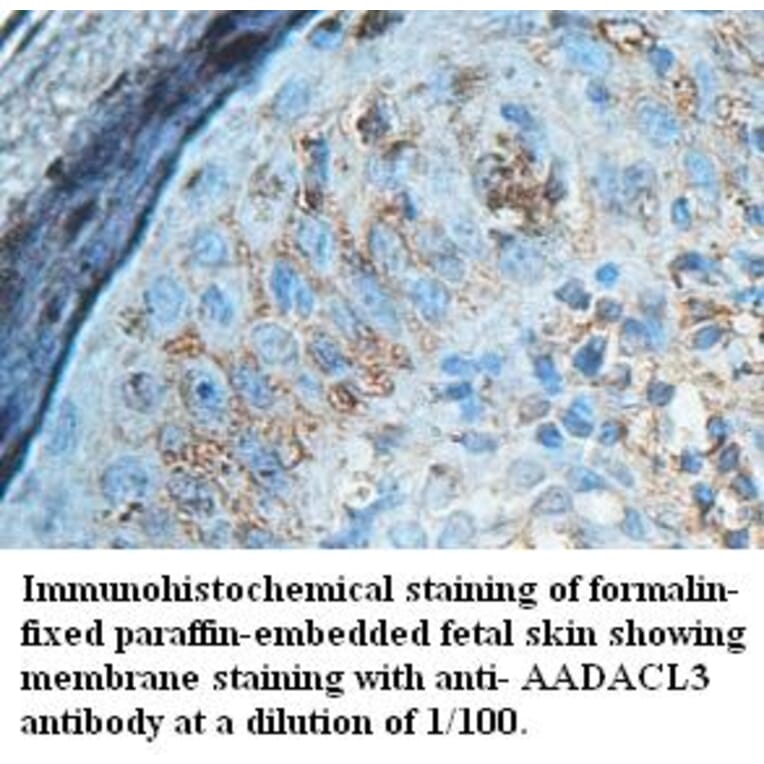 AADACL3 Antibody from Signalway Antibody (39428) - Antibodies.com