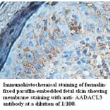 AADACL3 Antibody from Signalway Antibody (39428) - Antibodies.com