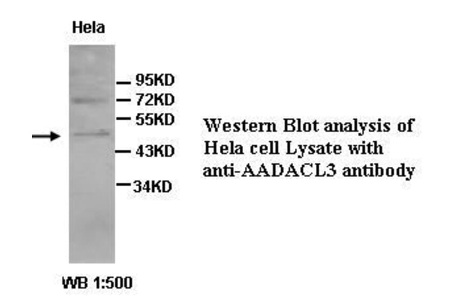 AADACL3 Antibody from Signalway Antibody (39428) - Antibodies.com