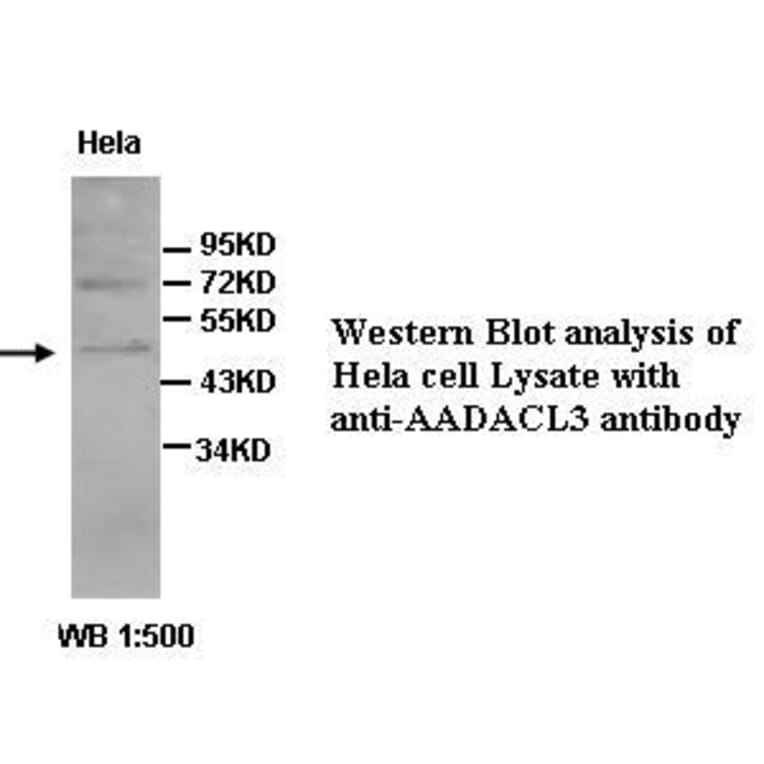 AADACL3 Antibody from Signalway Antibody (39428) - Antibodies.com