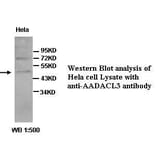 AADACL3 Antibody from Signalway Antibody (39428) - Antibodies.com