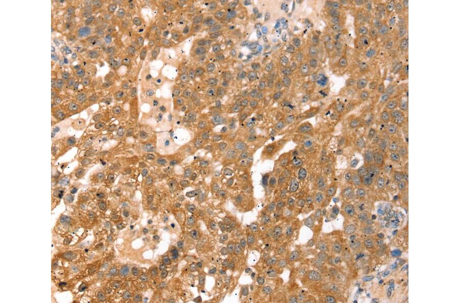 Immunohistochemistry - RPS6KA1 Antibody from Signalway Antibody (40085) - Antibodies.com