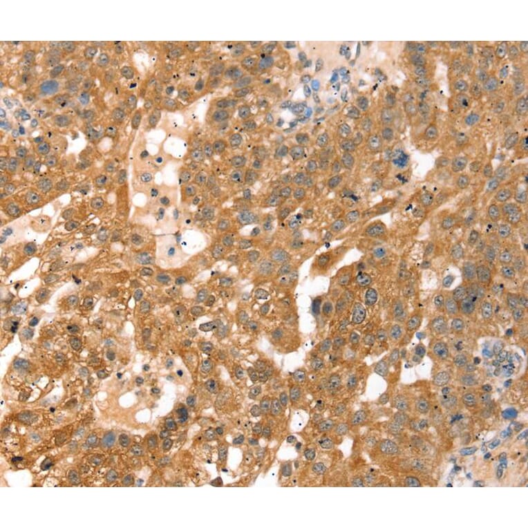 Immunohistochemistry - RPS6KA1 Antibody from Signalway Antibody (40085) - Antibodies.com