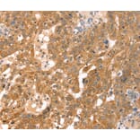 Immunohistochemistry - RPS6KA1 Antibody from Signalway Antibody (40085) - Antibodies.com