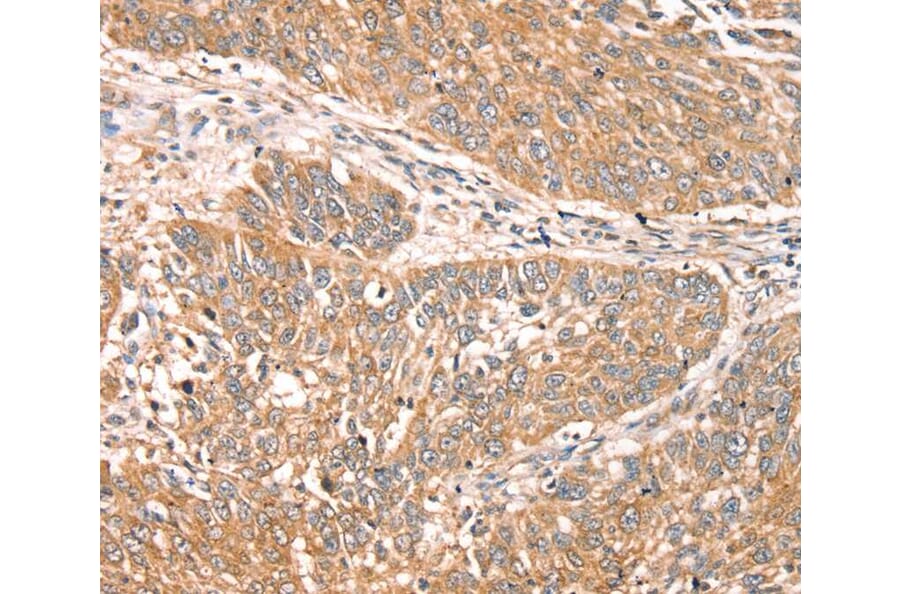 Immunohistochemistry - RPS6KA1 Antibody from Signalway Antibody (40085) - Antibodies.com