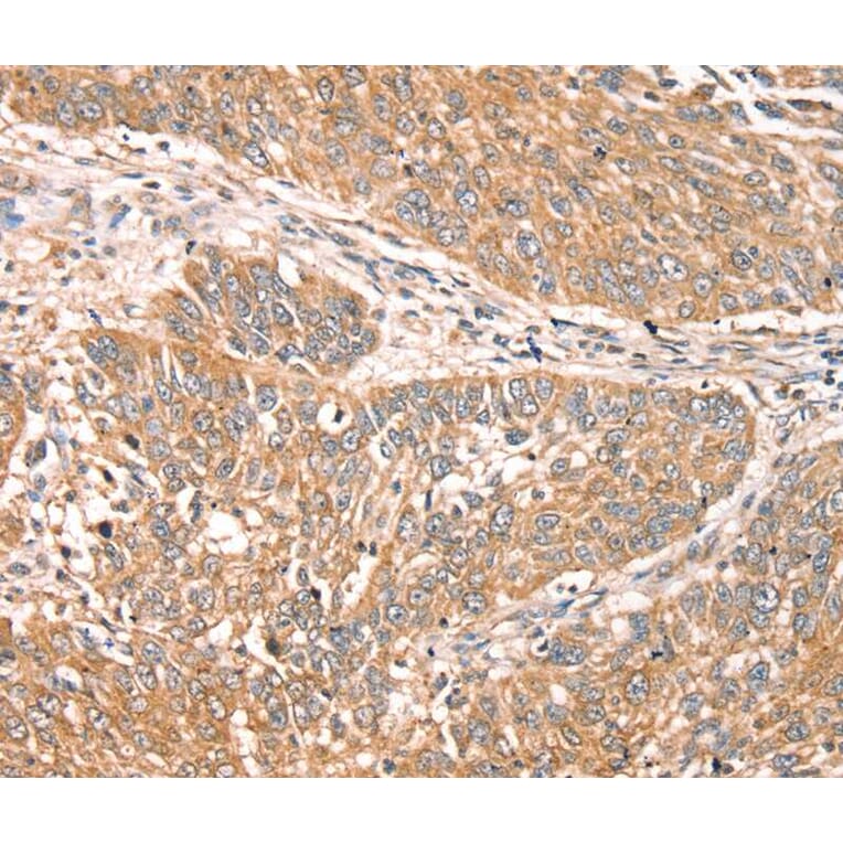 Immunohistochemistry - RPS6KA1 Antibody from Signalway Antibody (40085) - Antibodies.com