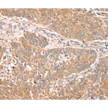 Immunohistochemistry - RPS6KA1 Antibody from Signalway Antibody (40085) - Antibodies.com