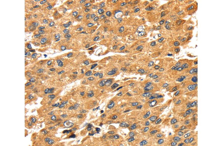 Immunohistochemistry - SH3KBP1 Antibody from Signalway Antibody (40103) - Antibodies.com