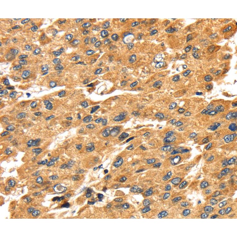 Immunohistochemistry - SH3KBP1 Antibody from Signalway Antibody (40103) - Antibodies.com