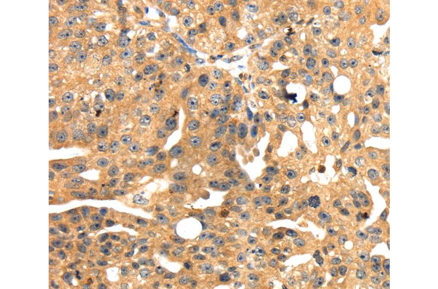 Immunohistochemistry - SH3KBP1 Antibody from Signalway Antibody (40103) - Antibodies.com