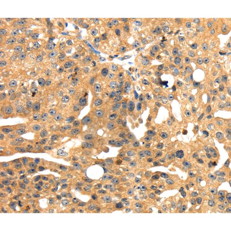 Immunohistochemistry - SH3KBP1 Antibody from Signalway Antibody (40103) - Antibodies.com