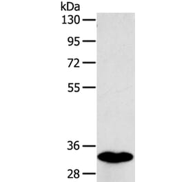 SULT1B1 Antibody from Signalway Antibody (40123) - Antibodies.com