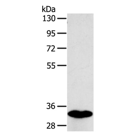 SULT1B1 Antibody from Signalway Antibody (40123) - Antibodies.com