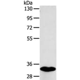 SULT1B1 Antibody from Signalway Antibody (40123) - Antibodies.com