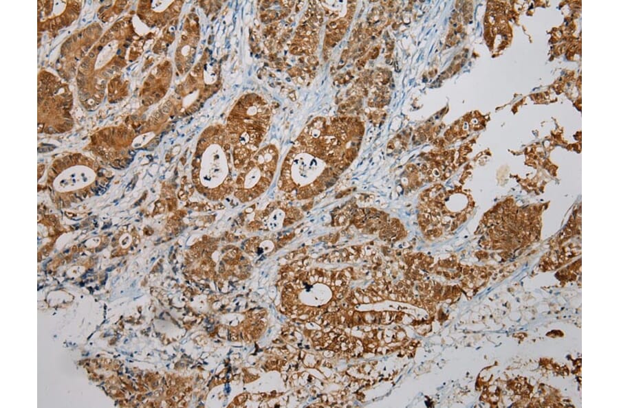 Immunohistochemistry - SULT1B1 Antibody from Signalway Antibody (40123) - Antibodies.com