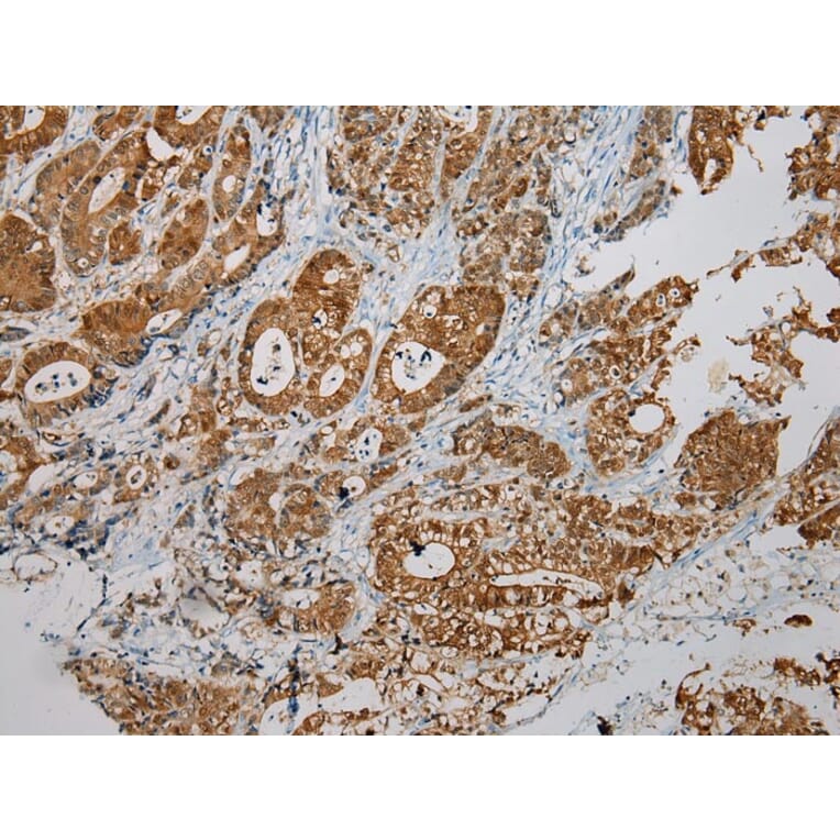 Immunohistochemistry - SULT1B1 Antibody from Signalway Antibody (40123) - Antibodies.com