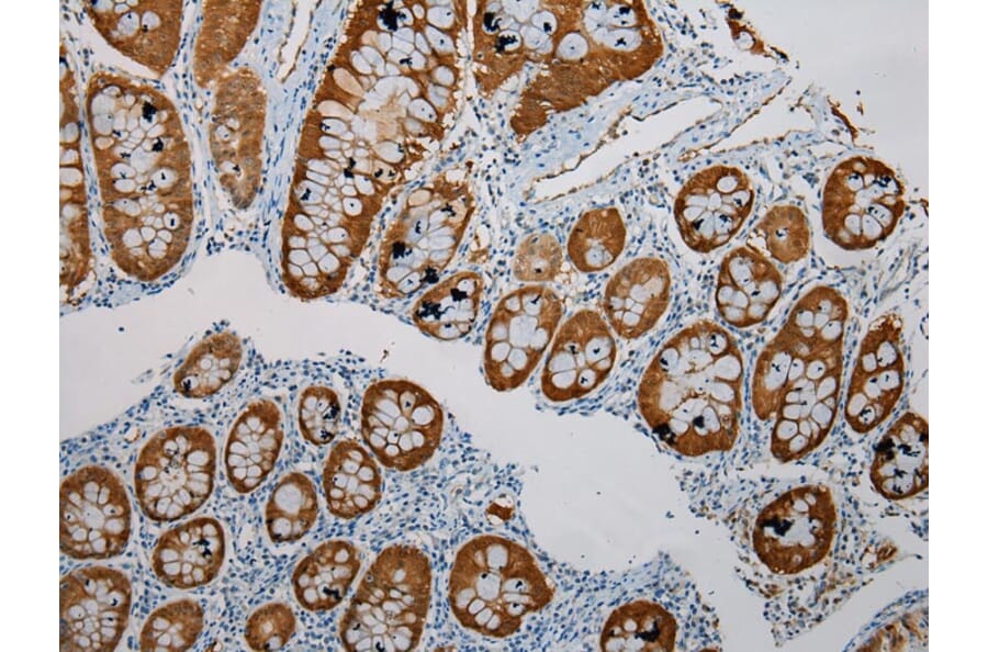 Immunohistochemistry - SULT1B1 Antibody from Signalway Antibody (40123) - Antibodies.com