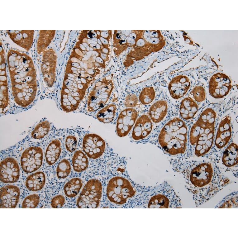 Immunohistochemistry - SULT1B1 Antibody from Signalway Antibody (40123) - Antibodies.com