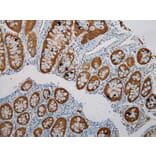 Immunohistochemistry - SULT1B1 Antibody from Signalway Antibody (40123) - Antibodies.com