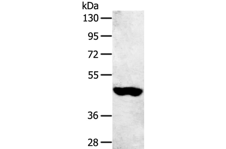 SULT2B1 Antibody from Signalway Antibody (40124) - Antibodies.com
