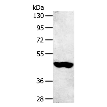 SULT2B1 Antibody from Signalway Antibody (40124) - Antibodies.com