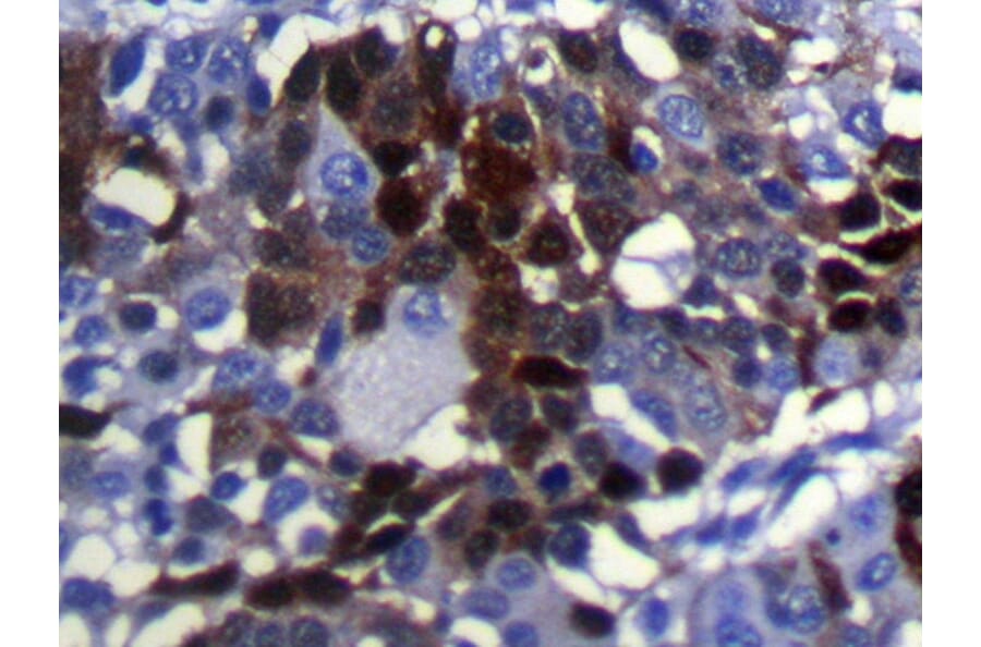 Immunohistochemistry - SULT2B1 Antibody from Signalway Antibody (40124) - Antibodies.com