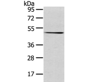 TMPRSS4 Antibody from Signalway Antibody (40158) - Antibodies.com