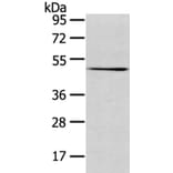 TMPRSS4 Antibody from Signalway Antibody (40158) - Antibodies.com