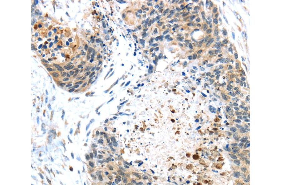 Immunohistochemistry - TMPRSS4 Antibody from Signalway Antibody (40158) - Antibodies.com