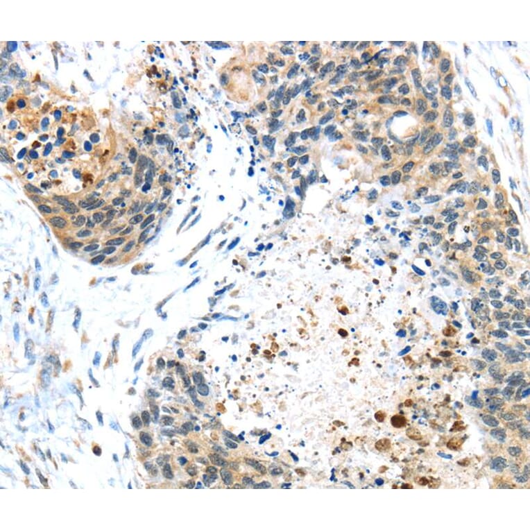 Immunohistochemistry - TMPRSS4 Antibody from Signalway Antibody (40158) - Antibodies.com