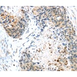 Immunohistochemistry - TMPRSS4 Antibody from Signalway Antibody (40158) - Antibodies.com