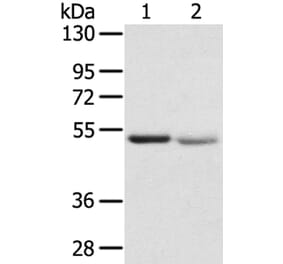 SLC24A6 Antibody from Signalway Antibody (40213) - Antibodies.com