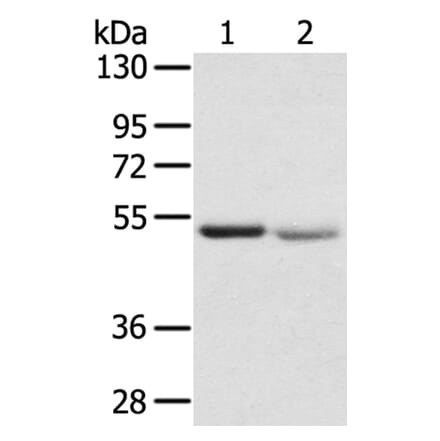 SLC24A6 Antibody from Signalway Antibody (40213) - Antibodies.com