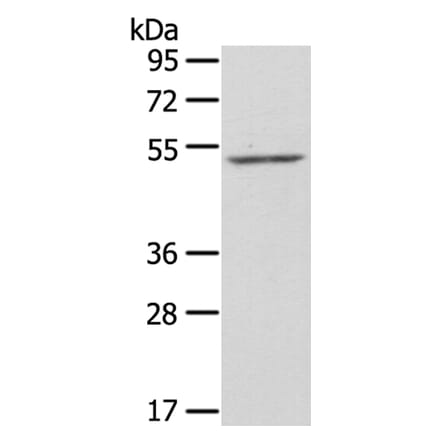 ZFP36L2 Antibody from Signalway Antibody (40250) - Antibodies.com