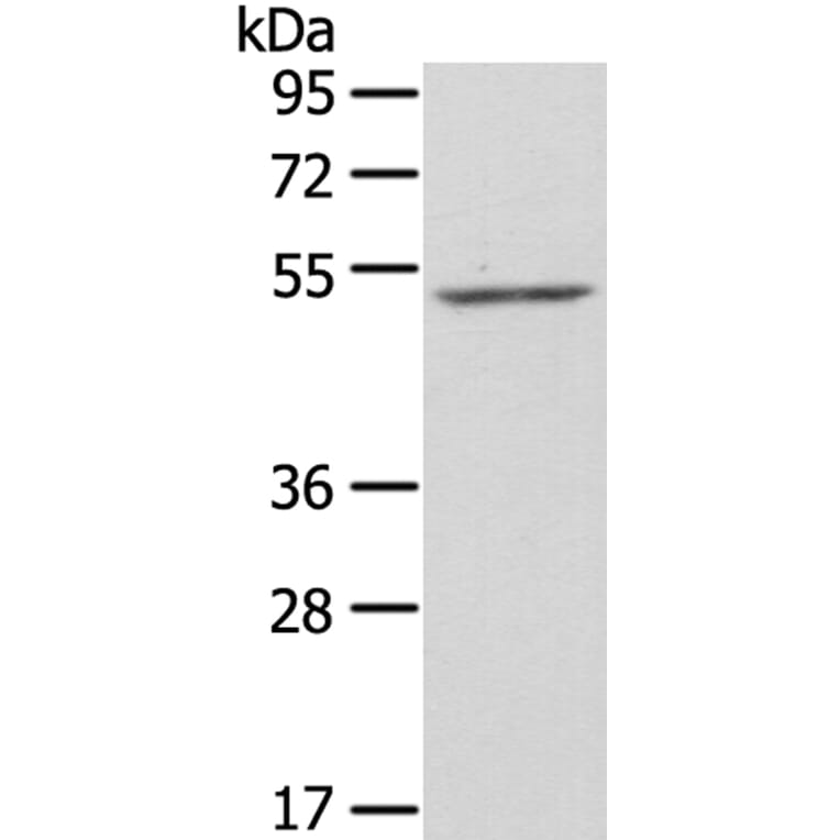 ZFP36L2 Antibody from Signalway Antibody (40250) - Antibodies.com
