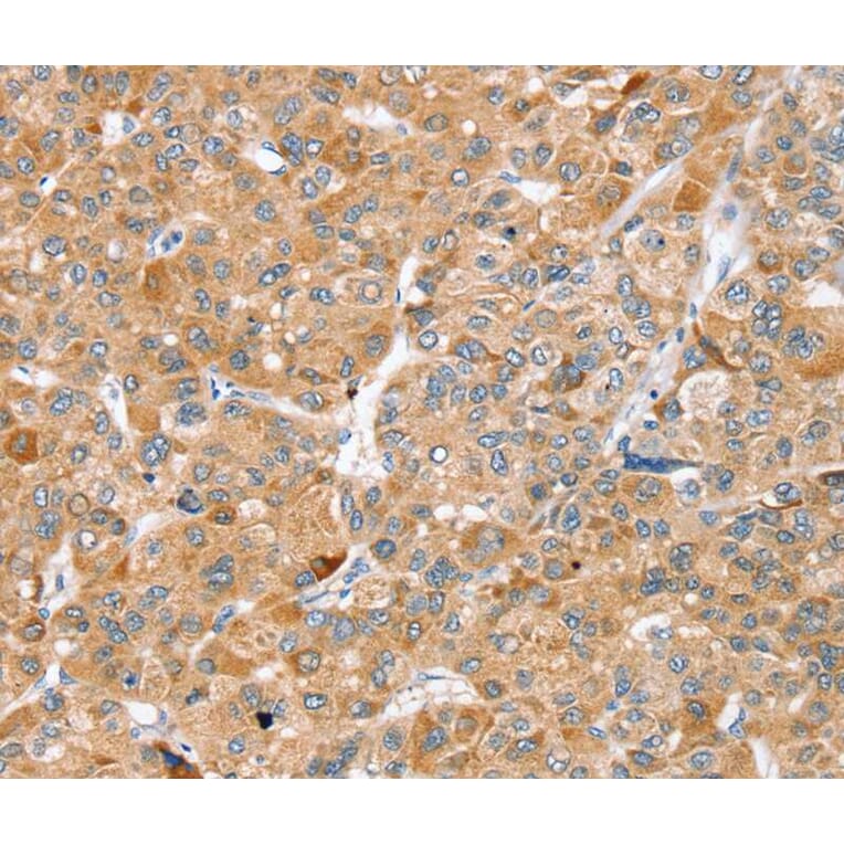 Immunohistochemistry - ZFP36L2 Antibody from Signalway Antibody (40250) - Antibodies.com