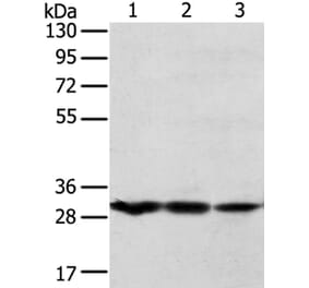 TPD52L2 Antibody from Signalway Antibody (40260) - Antibodies.com