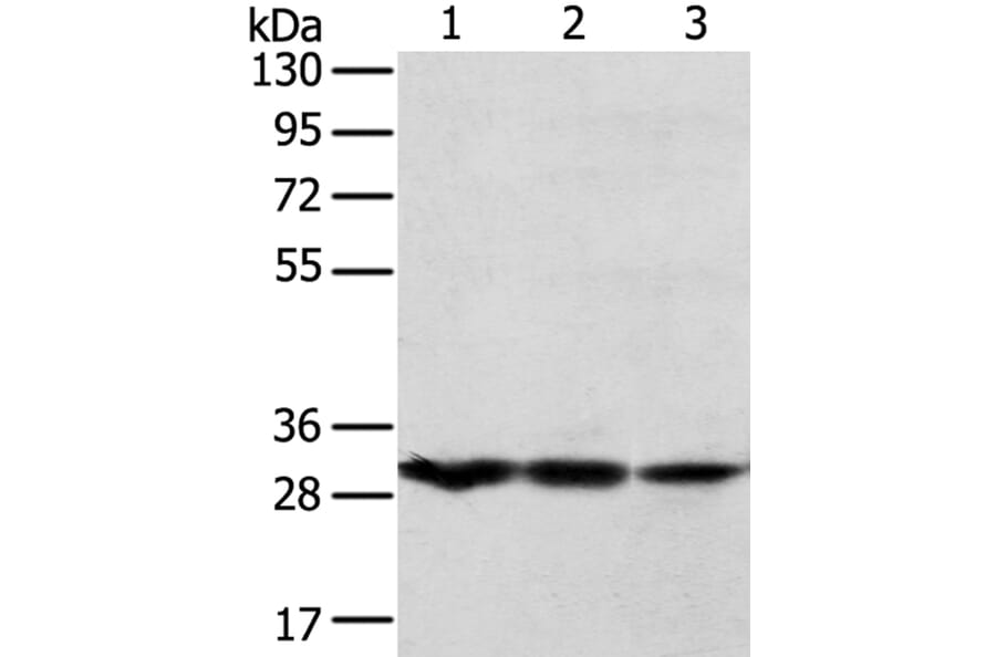 TPD52L2 Antibody from Signalway Antibody (40260) - Antibodies.com