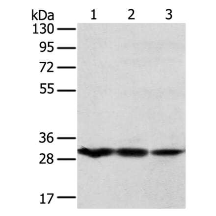 TPD52L2 Antibody from Signalway Antibody (40260) - Antibodies.com