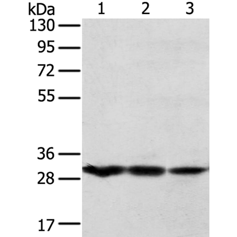 TPD52L2 Antibody from Signalway Antibody (40260) - Antibodies.com