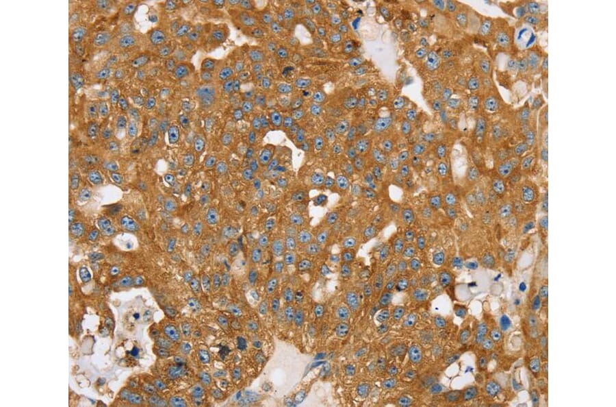 Immunohistochemistry - TPD52L2 Antibody from Signalway Antibody (40260) - Antibodies.com