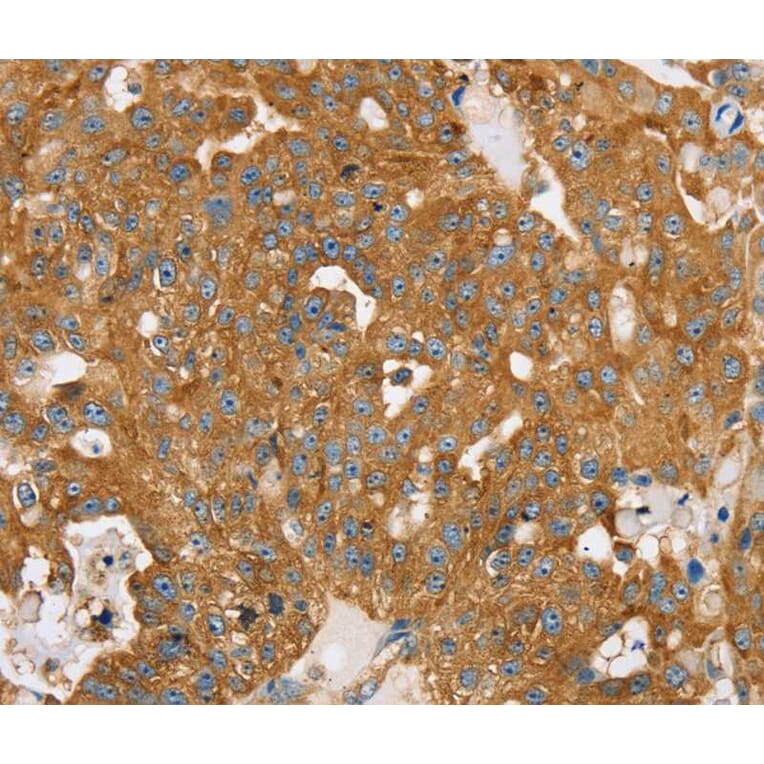 Immunohistochemistry - TPD52L2 Antibody from Signalway Antibody (40260) - Antibodies.com