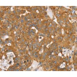 Immunohistochemistry - TPD52L2 Antibody from Signalway Antibody (40260) - Antibodies.com