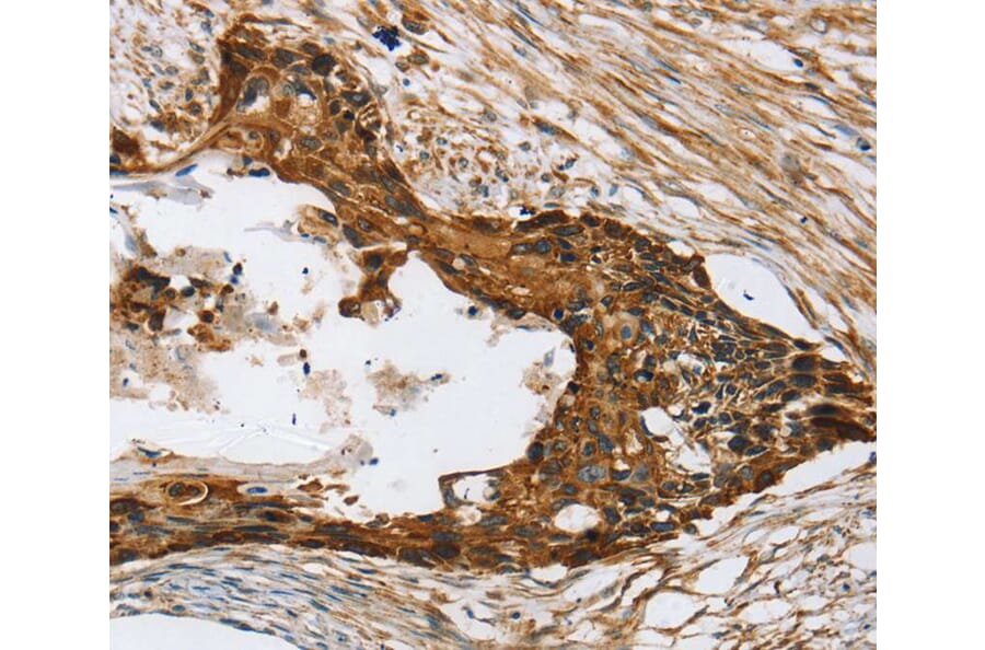 Immunohistochemistry - TPD52L2 Antibody from Signalway Antibody (40260) - Antibodies.com