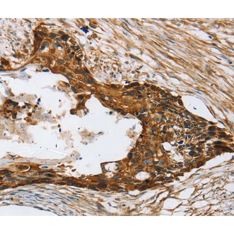 Immunohistochemistry - TPD52L2 Antibody from Signalway Antibody (40260) - Antibodies.com