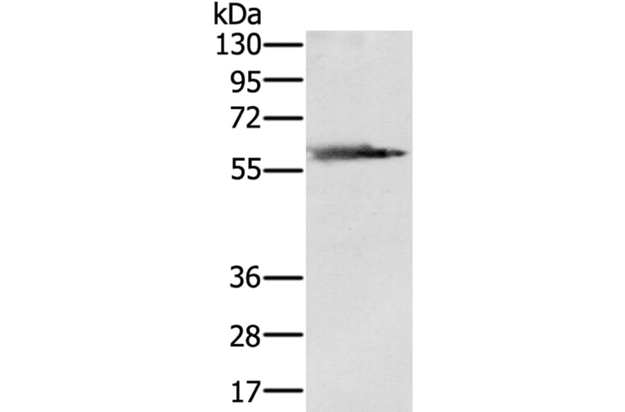 SLC29A4 Antibody from Signalway Antibody (40334) - Antibodies.com