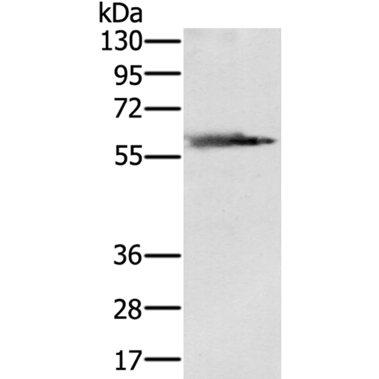 SLC29A4 Antibody from Signalway Antibody (40334) - Antibodies.com