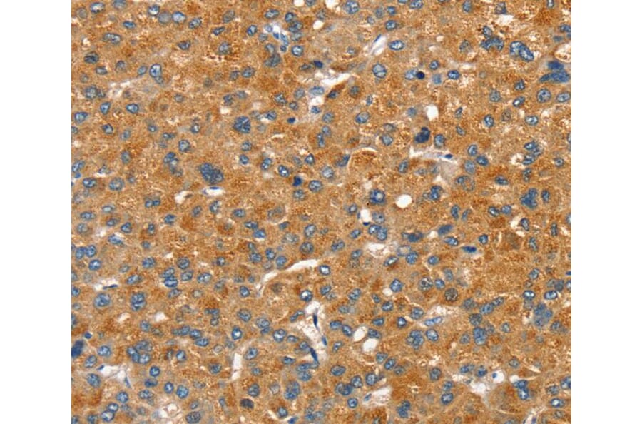 Immunohistochemistry - SLC29A4 Antibody from Signalway Antibody (40334) - Antibodies.com