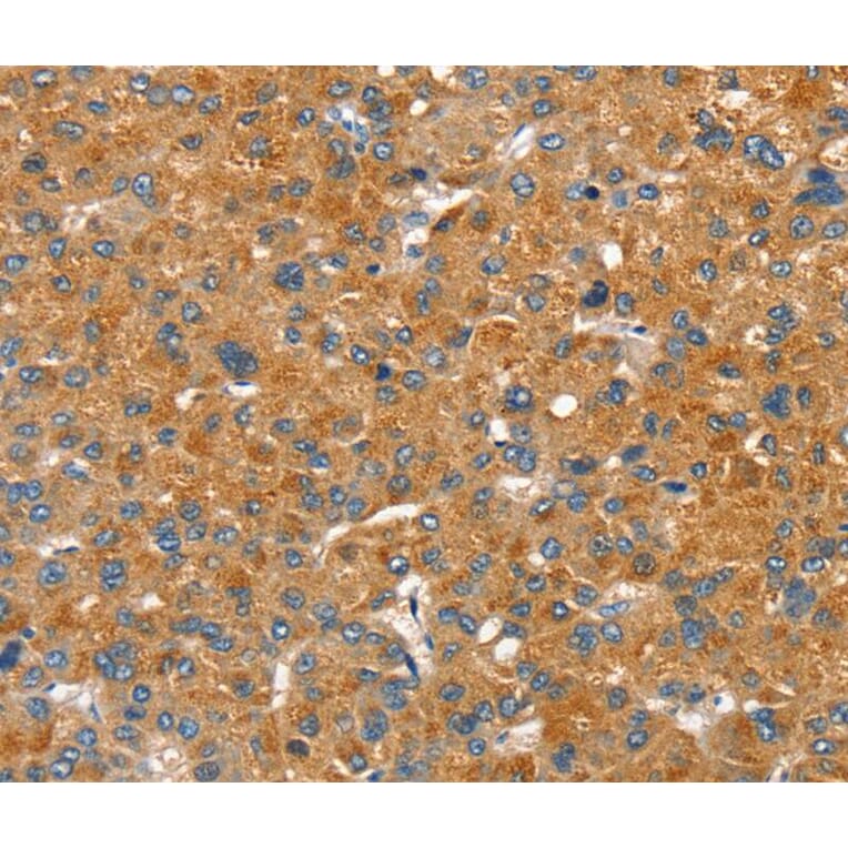 Immunohistochemistry - SLC29A4 Antibody from Signalway Antibody (40334) - Antibodies.com